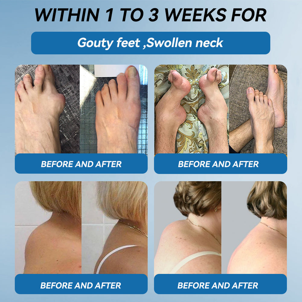 ⭕1️⃣| 𝐋𝐚𝐬𝐭 𝐃𝐚𝐲 𝐏𝐫𝐨𝐦𝐨𝐭𝐢𝐨𝐧 𝟖𝟎% 𝐎𝐅𝐅 | 𝑨𝑨𝑭𝑸® 𝐏𝐚𝐢𝐧 𝐑𝐞𝐥𝐢𝐞𝐟 𝐋𝐨𝐭𝐢𝐨𝐧- Treats Arthritis, Neuropathy, Rheumatism, Sports Injuries & More🏆