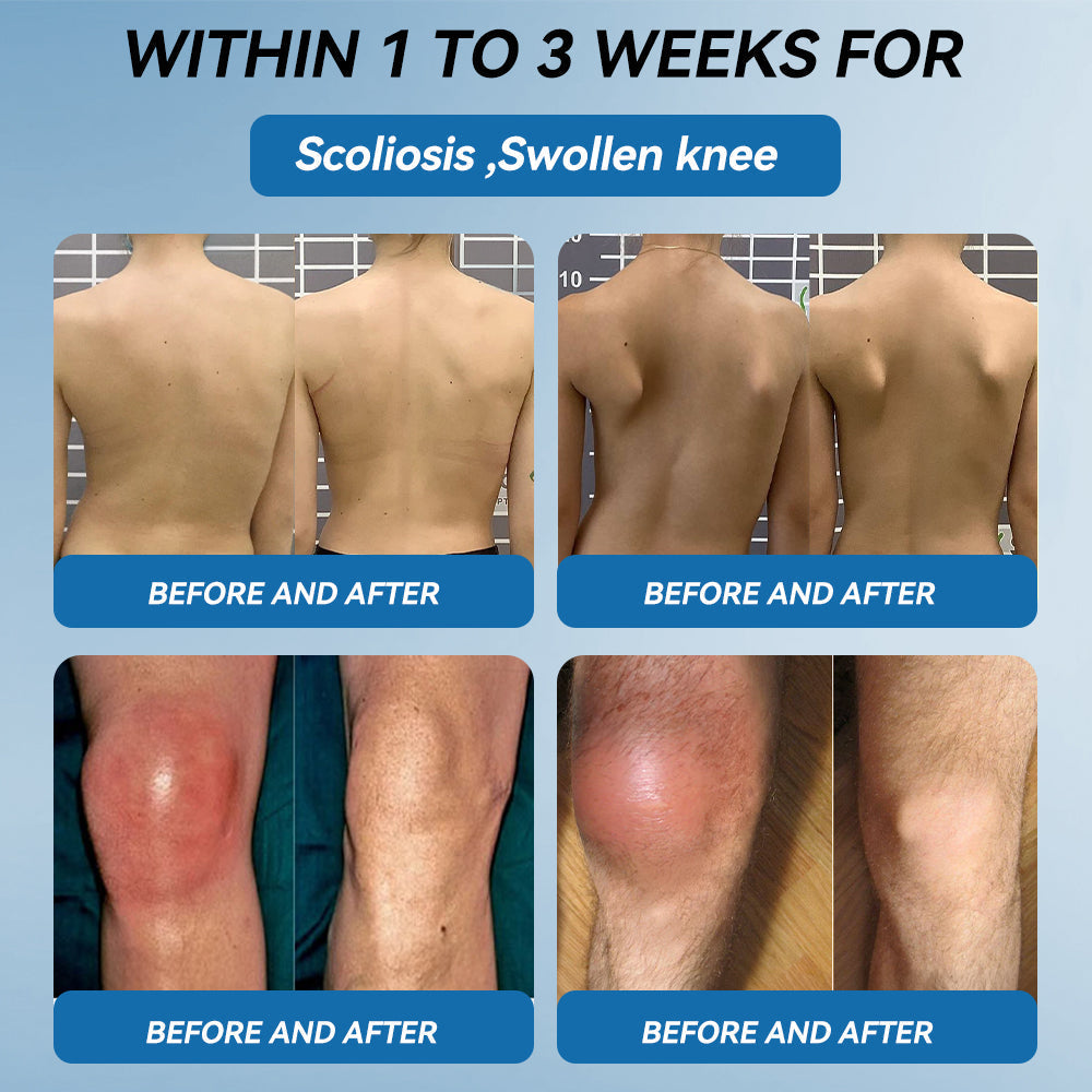 ⭕1️⃣| 𝐋𝐚𝐬𝐭 𝐃𝐚𝐲 𝐏𝐫𝐨𝐦𝐨𝐭𝐢𝐨𝐧 𝟖𝟎% 𝐎𝐅𝐅 | 𝑨𝑨𝑭𝑸® 𝐏𝐚𝐢𝐧 𝐑𝐞𝐥𝐢𝐞𝐟 𝐋𝐨𝐭𝐢𝐨𝐧- Treats Arthritis, Neuropathy, Rheumatism, Sports Injuries & More🏆