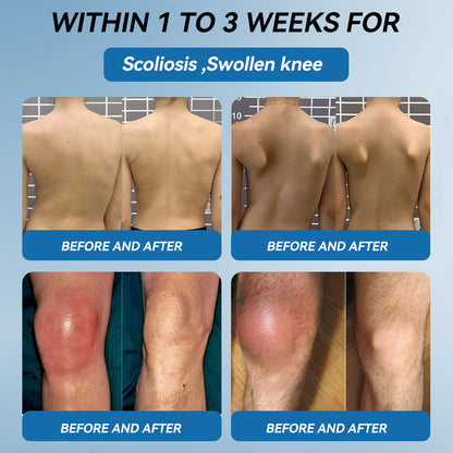 ⭕1️⃣| 𝐋𝐚𝐬𝐭 𝐃𝐚𝐲 𝐏𝐫𝐨𝐦𝐨𝐭𝐢𝐨𝐧 𝟖𝟎% 𝐎𝐅𝐅 | 𝑨𝑨𝑭𝑸® 𝐏𝐚𝐢𝐧 𝐑𝐞𝐥𝐢𝐞𝐟 𝐋𝐨𝐭𝐢𝐨𝐧- Treats Arthritis, Neuropathy, Rheumatism, Sports Injuries & More🏆