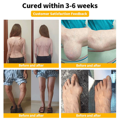 AAFQ® BeeThera – Bee Venom-Infused Relief for Joints & Bones | Natural Comfort & Mobility Support