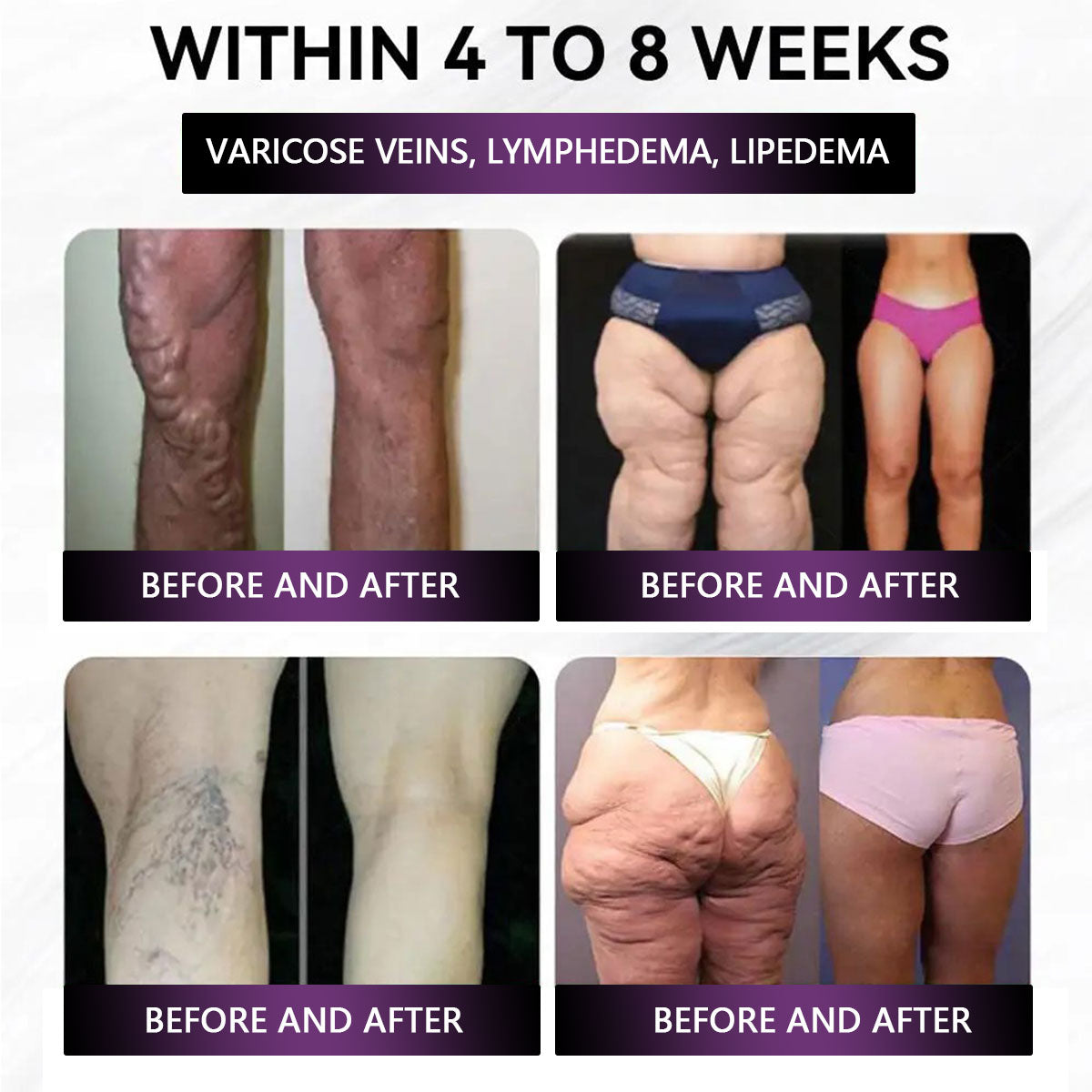 【US•FDA⛨】GreBree | 𝐀𝐀𝐅𝐐® 𝐆𝐋𝐏-𝟏 Pro