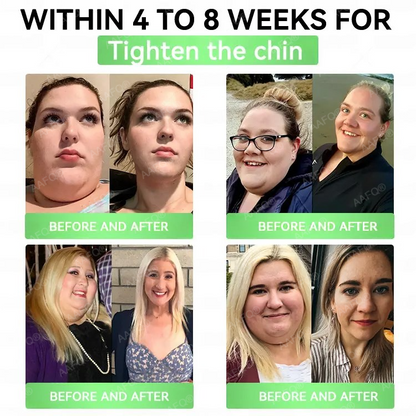 ®™©𝐅𝐃𝐀 𝐕𝐄𝐑𝐈𝐅𝐈𝐄𝐃⚕️AAFQ® GLP-1 6-in-1 Slim & Healthy Oral Solution (Once a day, results in 7 days), With 100 Billion CFU Active Probiotics 🌞 For obesity, abdominal bloating, sagging skin, diabetes, low energy, gut health, joint issues, and more