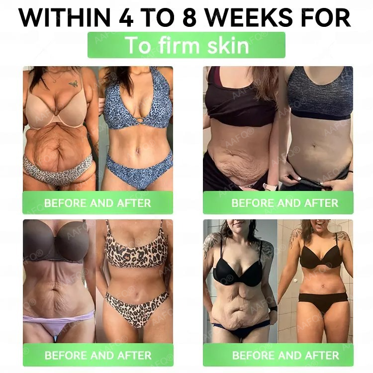 ®™©𝐅𝐃𝐀 𝐕𝐄𝐑𝐈𝐅𝐈𝐄𝐃⚕️AAFQ® GLP-1 6-in-1 Slim & Healthy Oral Solution (Once a day, results in 7 days), With 100 Billion CFU Active Probiotics 🌞 For obesity, abdominal bloating, sagging skin, diabetes, low energy, gut health, joint issues, and more